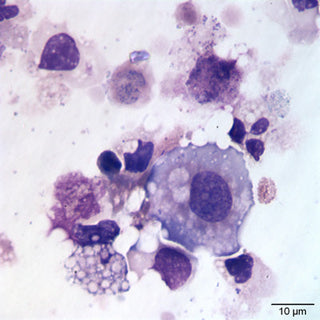 Urine & Sedimentation Analysis