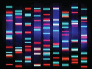 Electrophoresis