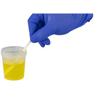 URYXXON Relax Urine Test Strip Analyzer 93088